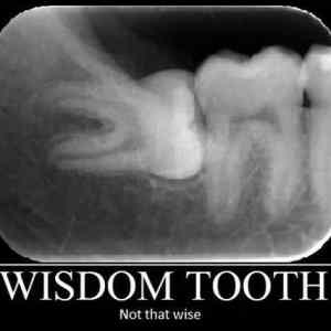 Obrázek 'Wisdom Tooth'