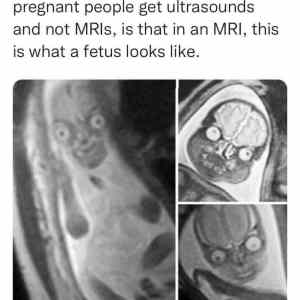 Obrázek 'fakt fetus'