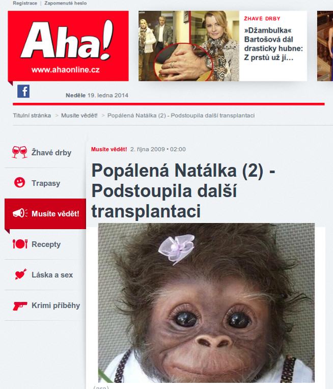 Obrázek aha popalena natalka