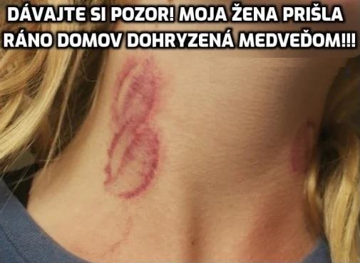 Obrázek dohryzena medvedom