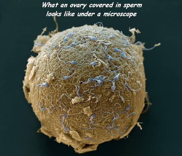 Obrázek sperm-microscope  