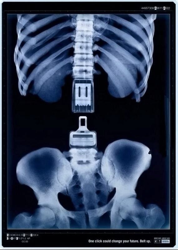 Картинки x ray