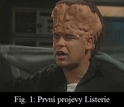 prvni_projevy.jpg prvni_projevy.jpg