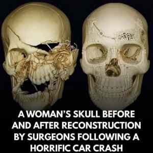 asi&nbsp;novy&nbsp;usmev